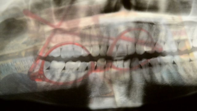 Dentista دندانساز 歯医者 Zahnarzt