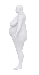 Obese woman in anatomical position lateral view