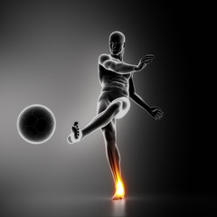 Soccer player ankle joint injury