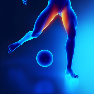 Strained thigh muscle concept in x-ray