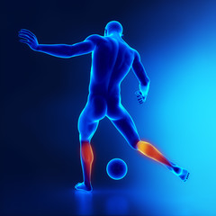 Strained calf muscle concept in x-ray © CLIPAREA.com