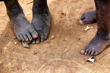 Feet