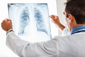 Doctor examining a radiography - obrazy, fototapety, plakaty