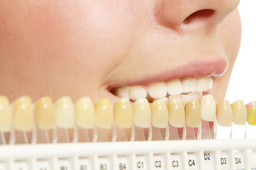 Testing whiteness of teeth of a patient - close-up image