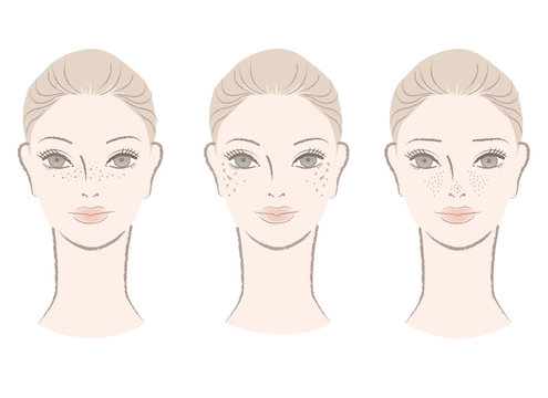 6 Best 老人性色素斑images Stock Photos Vectors Adobe Stock 6 Best 老人性色素斑images Stock Photos Vectors Adobe Stock
