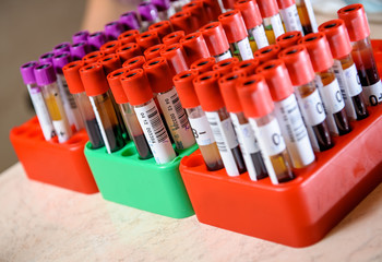 Medical test-tube with blood samples