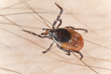 Tick feeding on human, extreme close up with high magnification