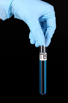 Test tube labeled Tuberculosis(TB) in hand isolated on black