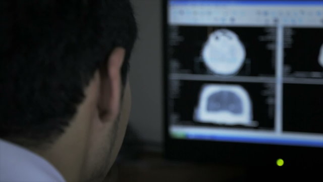 Doctor examining Neuroimaging at computer