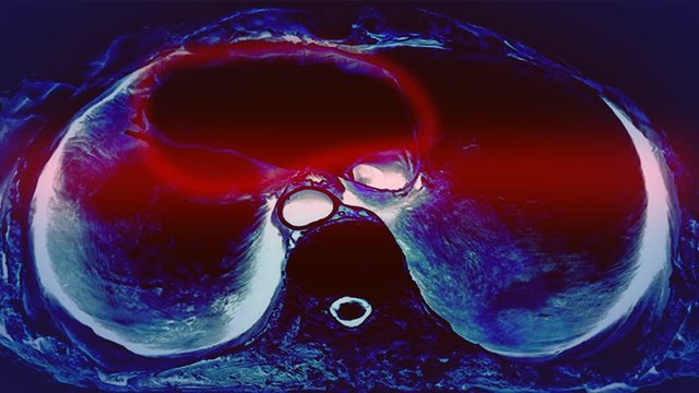 Tomography scanning