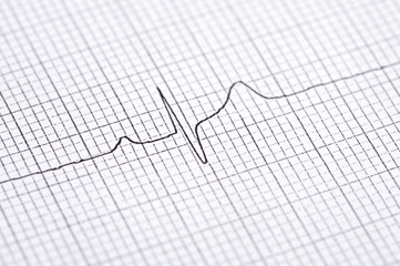 Naklejka premium Electrocardiogram graph