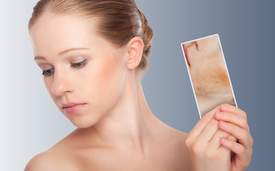 concept skincare . Skin of beauty young woman with redness, skin