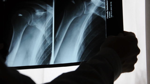 Arzt mit R&ouml;ntgenbilder