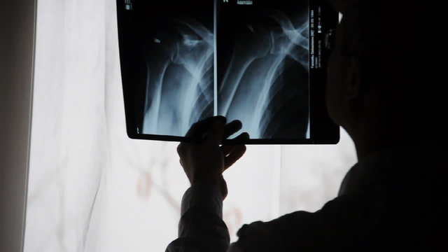 Arzt mit Röntgenbilder