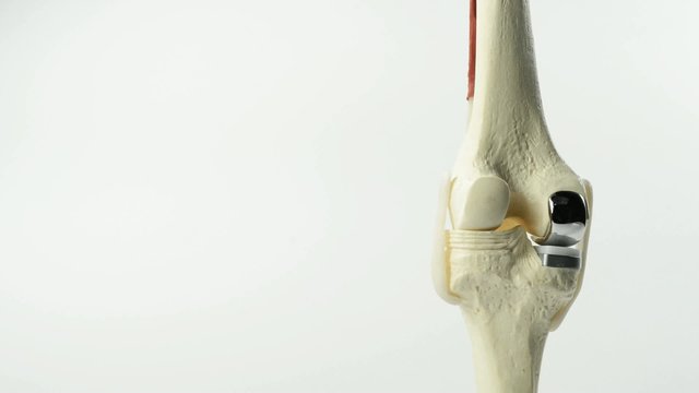 anatomic study model of an human knee replacement