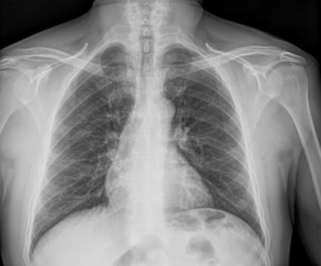 Medical X-rays