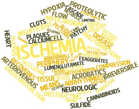 Word cloud for Ischemia