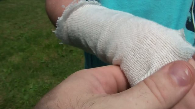 Soft Cast on Arm Fitting