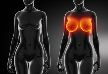 Female breast comparison after plastic surgery