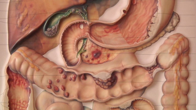 human anatomy, abdomen , pan