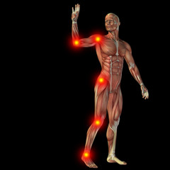 High resolution conceptual 3D human with inflammation