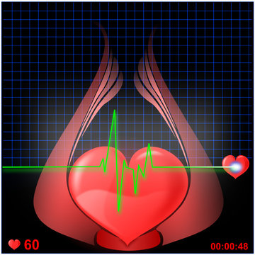Herz EKG