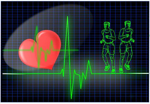 EKG Untersuchung
