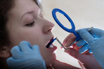 Technique of taking tooth x-ray