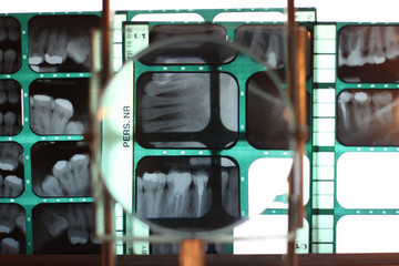 Examining patient teeth