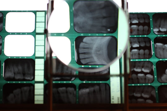 Diagnostic process in dental practice