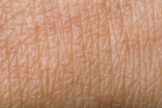 Human skin