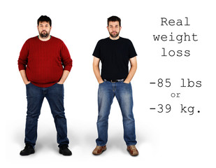 Before and after weight loss - 48091672