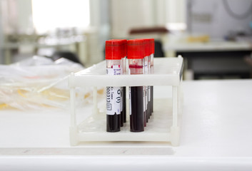 Blood test