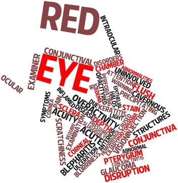 Word cloud for Red eye
