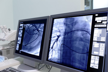 Monitor screen in radiology. - obrazy, fototapety, plakaty