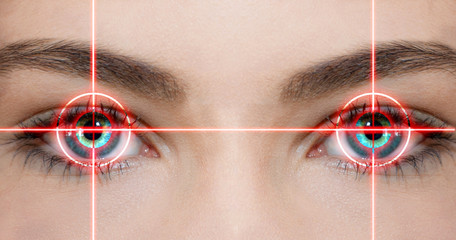 Augenlaser