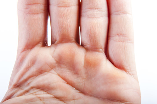 Part of the hand