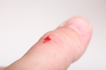 disinfect the scratch alcohol cuts hand health