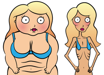 Anorexy and overweight girl