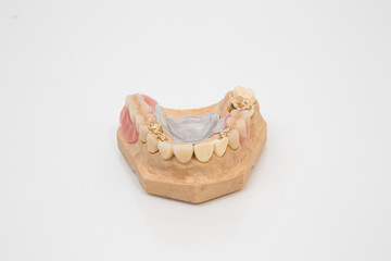 Sophisticated dental prosthesis