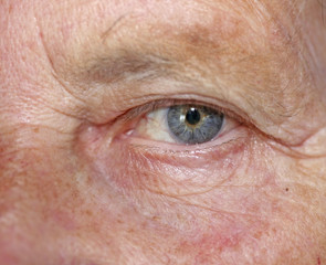 Old women eye