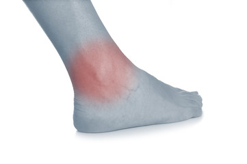 Acute pain in a woman ankle