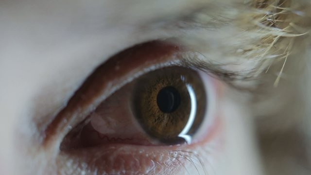 eye macro