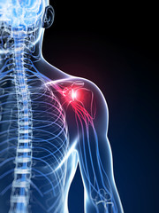 3d rendered illustration of a painful shoulder