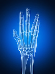 Obraz premium 3d rendered illustration of an arthritic hand
