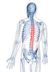 3d rendered illustration of a painful back