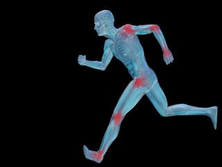 High resolution conceptual 3D human with inflammation