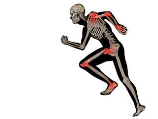 High resolution conceptual 3D human with inflammation