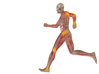 High resolution conceptual 3D human with inflammation