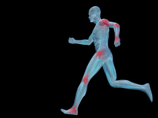 Fototapeta na wymiar High resolution conceptual 3D human with inflammation